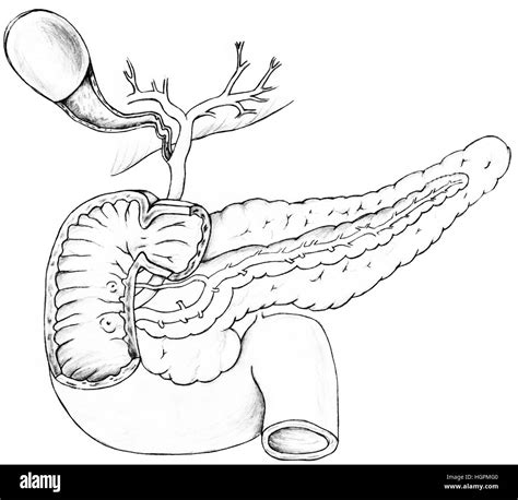 Gall Bladder, Pancreas and Duodenum.The gallbladder holds bile produced in the liver until it is ...