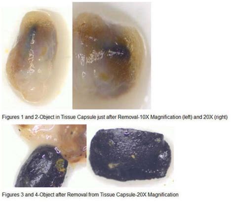 Image result for Alien Implants Just Schrapnel