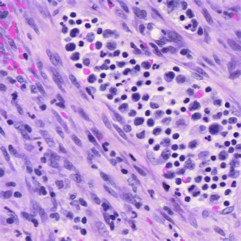 Spindle Shape 的图像结果