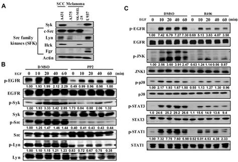 Synergistic Anti-Tumour Effect of Syk Inhibitor and Olaparib in ...