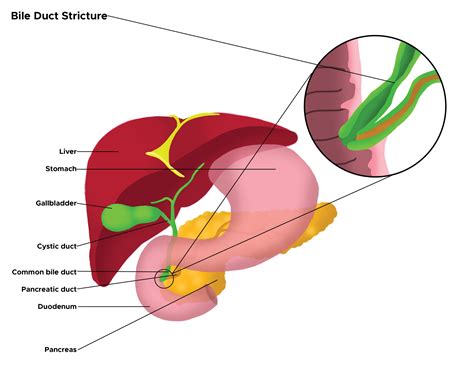 Common Bile Duct