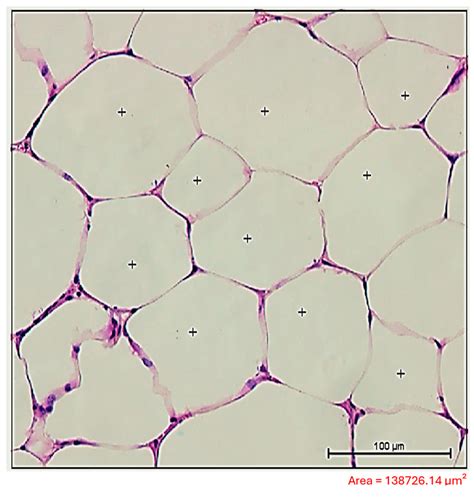 The Intersection Between Schistosoma mansoni Infection and Dyslipidemia ...