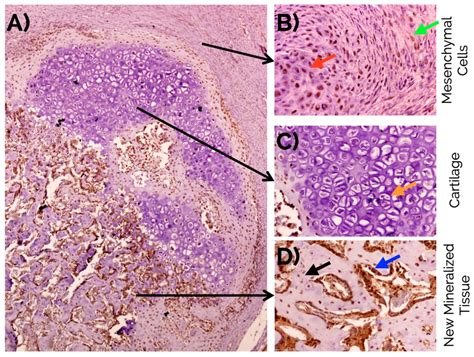 Expression of Musashi-1 Increases in Bone Healing