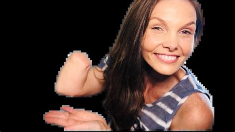 Comprehensive Guide on Below Elbow Amputation