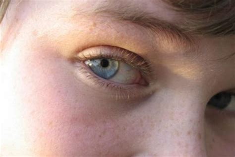 男的右眼跳是什么预兆 右眼跳代表什么 - 致富热