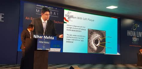 Interventional Gallery of Dr. Nihar Mehta