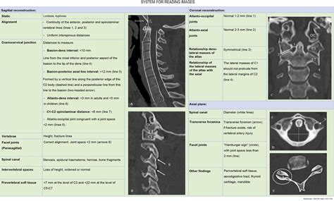 Cervical spine trauma | Radiología (English Edition)