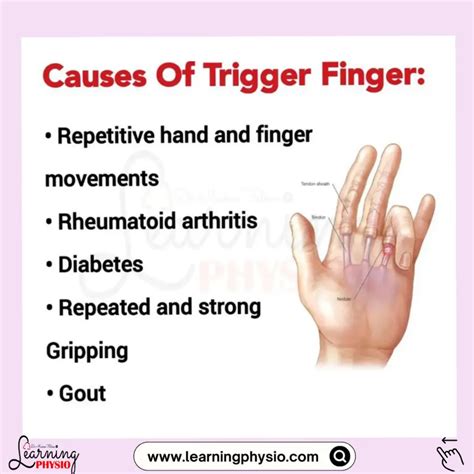 Trigger Finger Definition Etiology Symptoms Diagnosis Evaluation And
