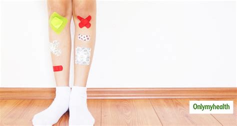 What Is Osteosarcoma Cancer That Sushant Singh Rajput Is Suffering From ...