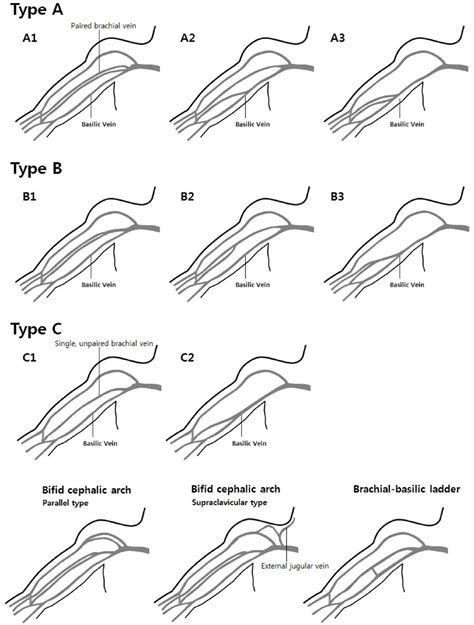 Upper Arm Veins Upper Limb Veins Anatomyzone 20190106