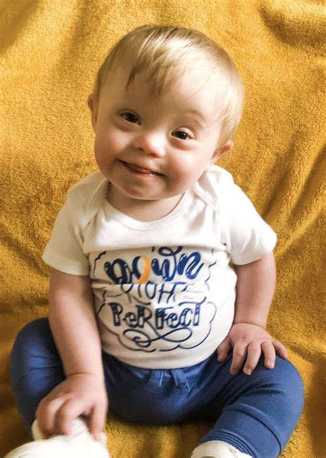 Down Syndrome Pictures Infants
