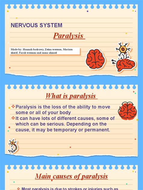 Paralysis 的图像结果