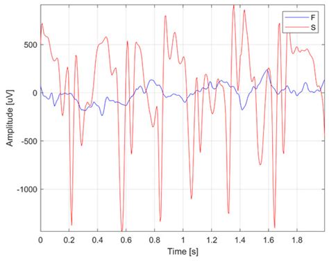 Implementation of Machine Learning and Deep Learning Techniques for the ...