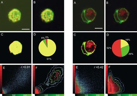 Image result for ImageJ Colocalization Coloc