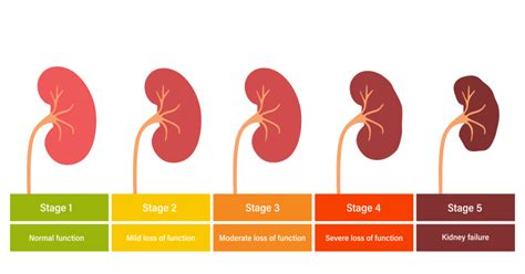 Can Ayurvedic Remedy To Shrink Kidney Cysts Prevent Damage?