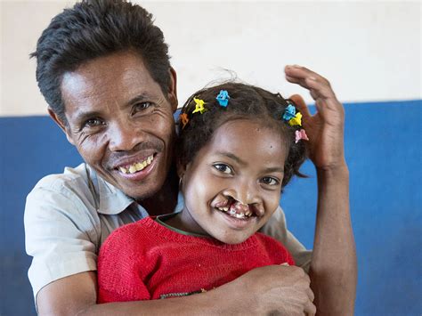 Madagascar | Operation Smile