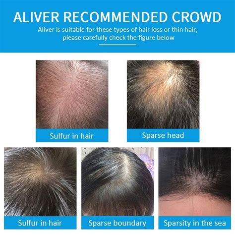 Buy Hair Building Fibers, Hair Thickening Fibers for Thinning Hair ...