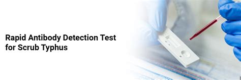 Rapid Antibody Detection Test for Scrub Typhus