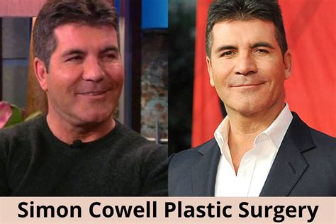 Simon Cowell Plastic Surgery: What Do You Think Of Her New Look?
