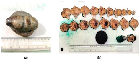 Actualities in the Morphology and Immunohistochemistry of Cutaneous and ...