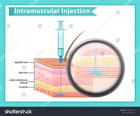 Injection Medicine 的图像结果