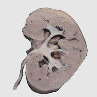 Excretory System | Museum of Anatomy and Pathology, Manipal Academy of ...