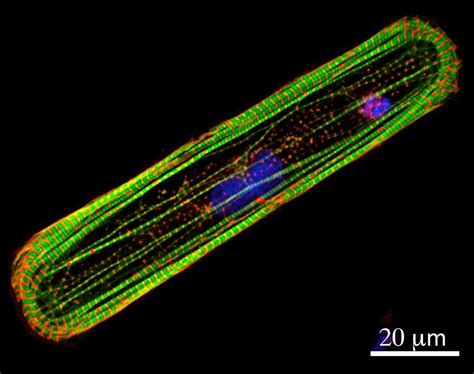 Stem Cell-Based Tool Ranks Heart Toxicity of Cancer Drugs - NCI