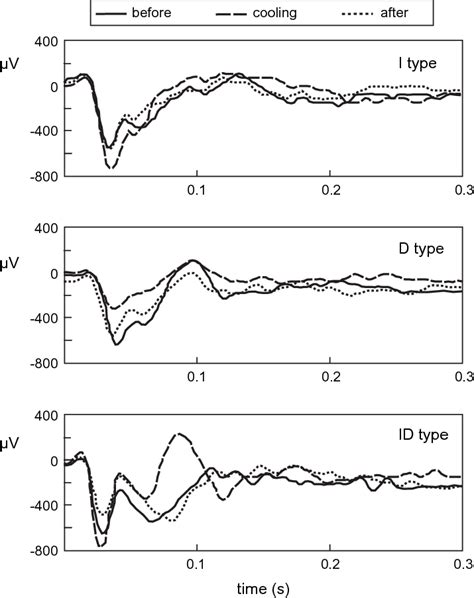 Image result for Contralateral Hemisphere