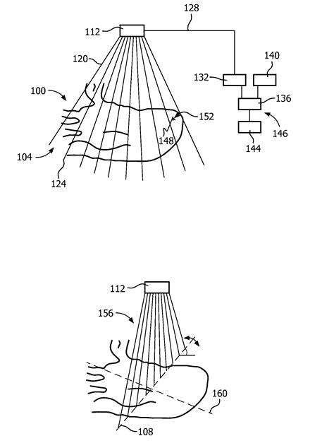 Automatic imaging plane selection for echocardiography - Eureka | Patsnap
