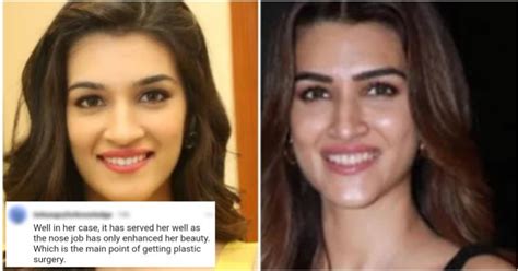 Kriti Sanon's Nose Job Pics Surface On The Internet & For A Change ...