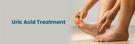 Best Treatments for High Uric Acid