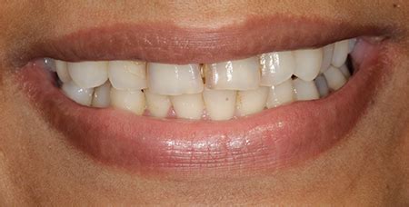 Our Work | Kamala Dental Care