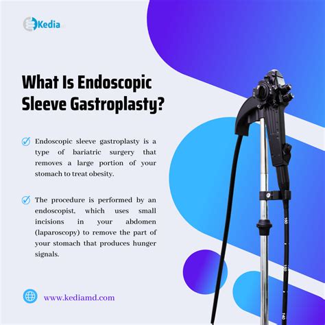 What Is The Cost Of Endoscopic Sleeve Gastroplasty at Henry Briggs blog