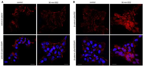 Oestrogen Activates the MAP3K1 Cascade and β-Catenin to Promote ...