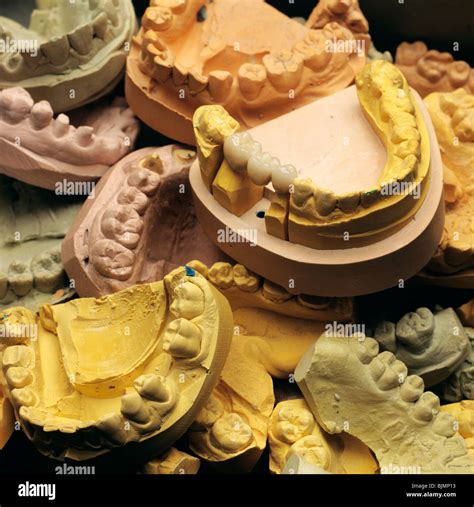 Image result for How to Take Study Models with Plaster Lab