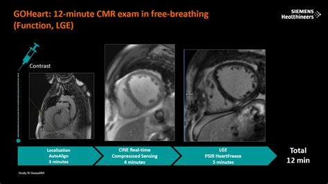 Cardiac Dot Engine - Siemens Healthineers India