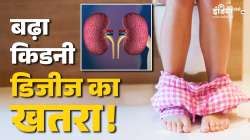 yoga for eyes eyesight improvement tips Best Exercises to Cure Cataract ...