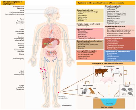Weil’s Disease in an HIV-Infected Patient: A Case Report and Literature ...