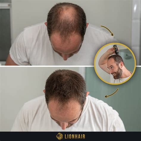 Buy LIONHAIR New Premium Hair Building Fibers for Thinning Hair ...