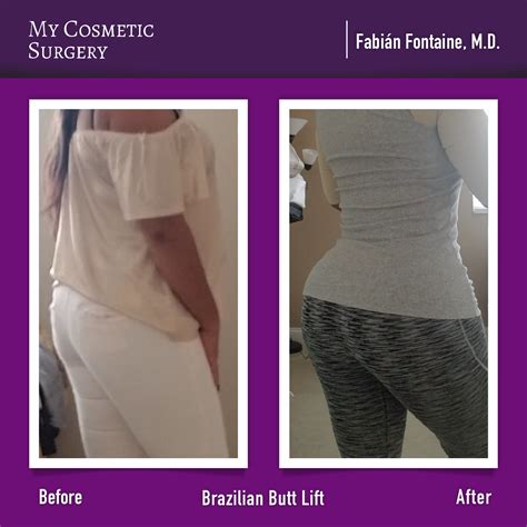 Pin on Before and after