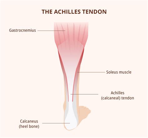 Achilles Tendon Rupture Test: Diagnosis and Treatment | Healthnews