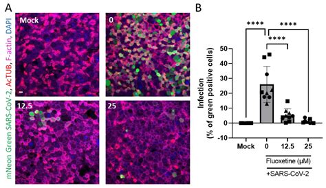 Antiviral and Anti-Inflammatory Activities of Fluoxetine in a SARS-CoV ...