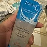D’Acne Soft Face Wash | Unclogs pores and prevents pimples | Stops ...