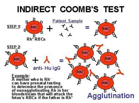 Image result for Coombs Test Positive vs Negative