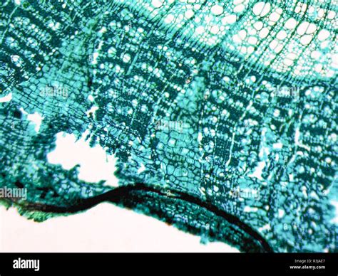 Image result for Function of Pith Class 11