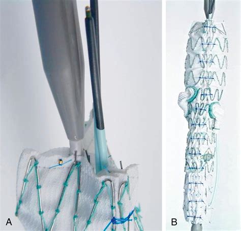 Fenestrated and Branched Endograft Treatment of Juxtarenal ...