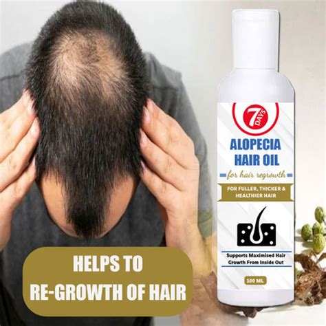 7 Days Alopecia Hair loss Treatment Oil for hair Regrowth hair loss ...