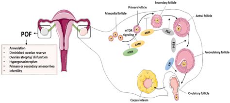 Early Menopause Vs Premature Ovarian Failure at Trevor Roy blog