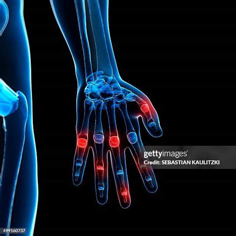 Image result for Finger Joint Tutorial