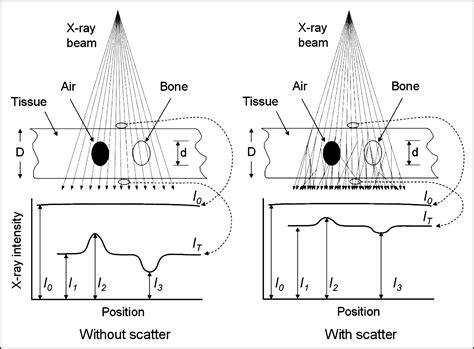 X-Ray Imaging Physics for Nuclear Medicine Technologists. Part 2: X-Ray ...